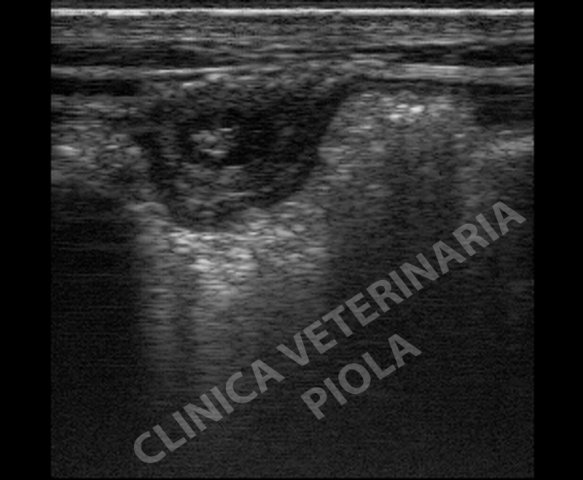 Struttura ombelicale di un neonato 